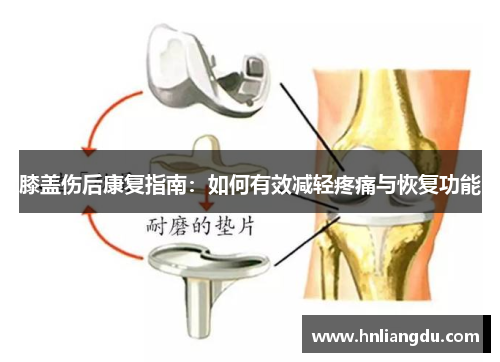 膝盖伤后康复指南：如何有效减轻疼痛与恢复功能